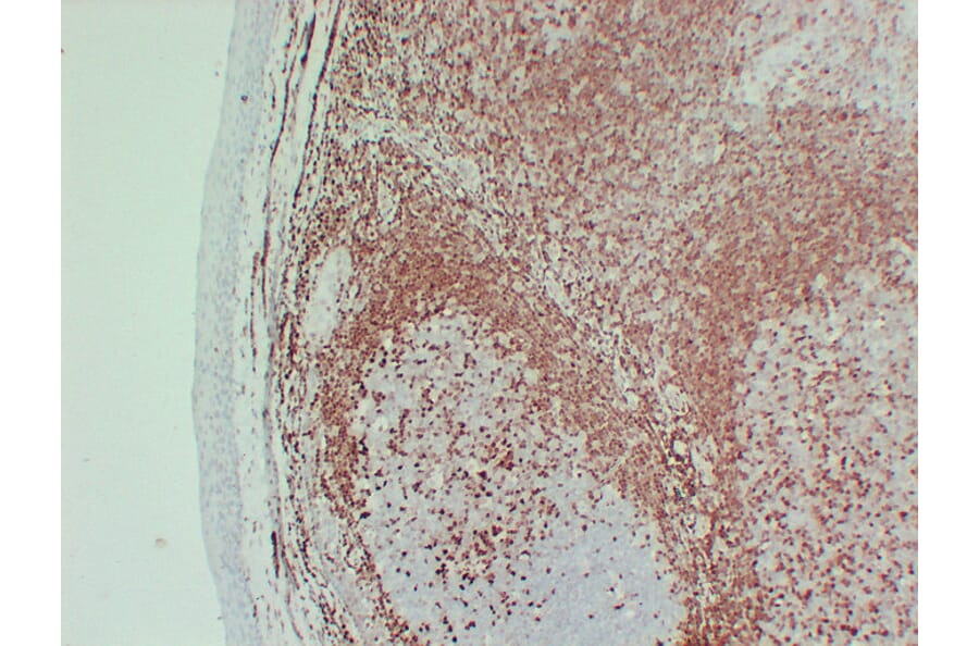 Immunohistochemistry - Anti-p27Kip1 Antibody (V0143) - Antibodies.com