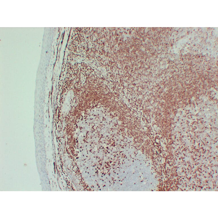 Immunohistochemistry - Anti-p27Kip1 Antibody (V0143) - Antibodies.com