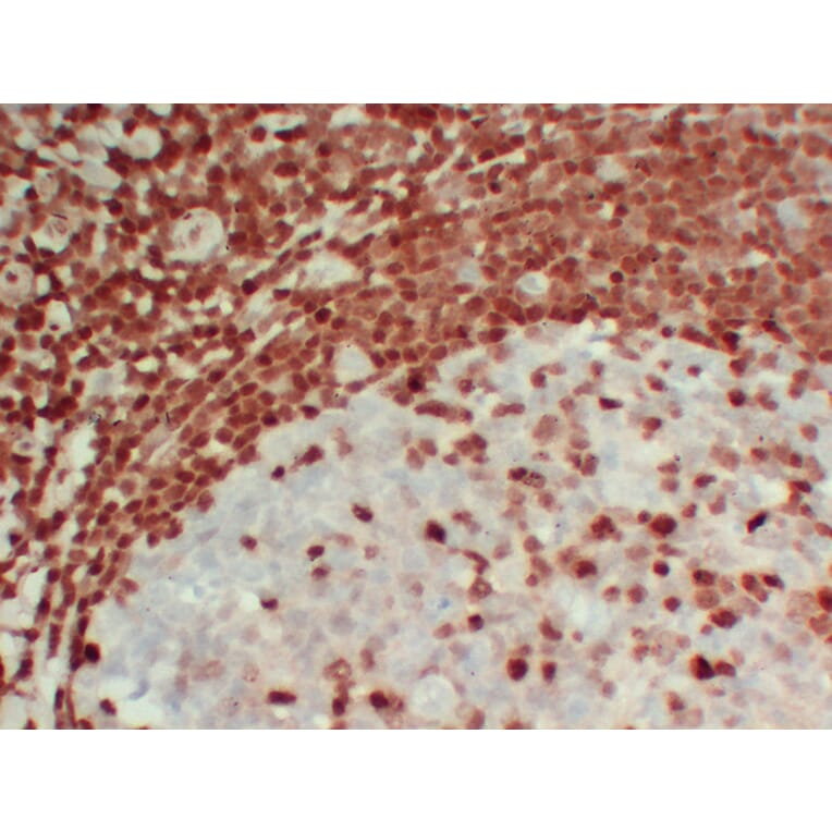 Immunohistochemistry - Anti-p27Kip1 Antibody (V0143) - Antibodies.com