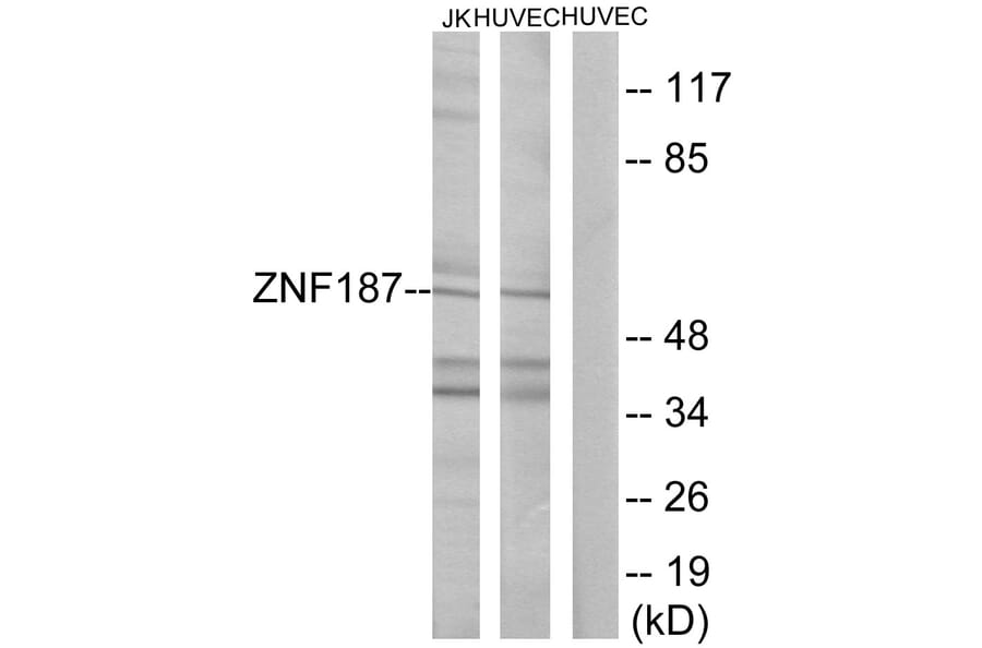 Western Blot - Anti-ZNF187 Antibody (C11138) - Antibodies.com