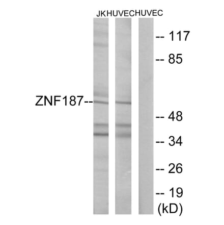 Western Blot - Anti-ZNF187 Antibody (C11138) - Antibodies.com