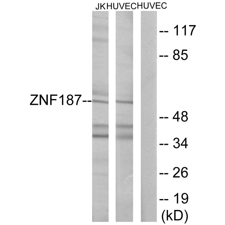 Western Blot - Anti-ZNF187 Antibody (C11138) - Antibodies.com