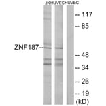 Western Blot - Anti-ZNF187 Antibody (C11138) - Antibodies.com
