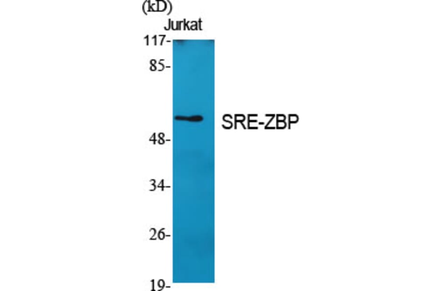 Western Blot - Anti-ZNF187 Antibody (C11138) - Antibodies.com