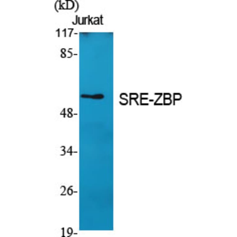 Western Blot - Anti-ZNF187 Antibody (C11138) - Antibodies.com