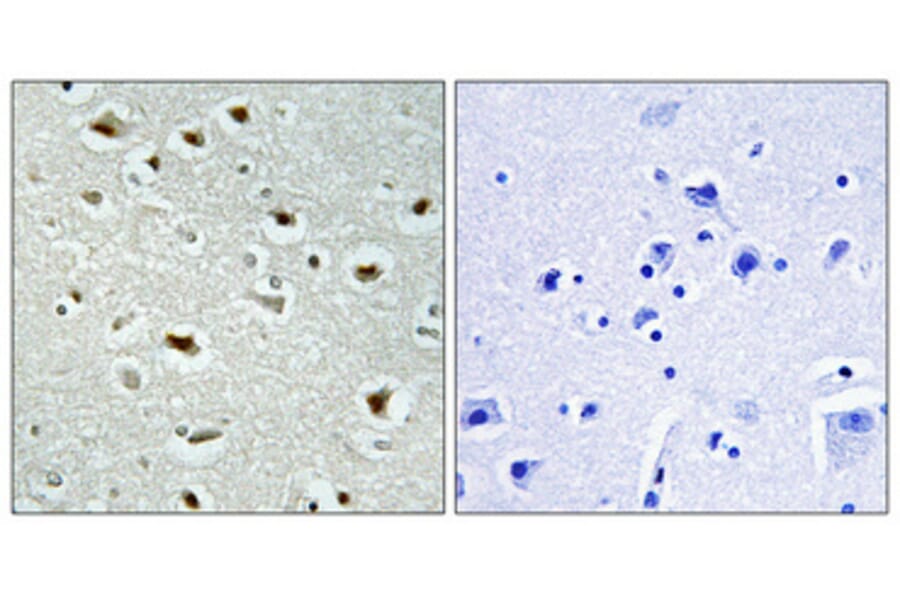 Immunohistochemistry - Anti-ZNF187 Antibody (C11138) - Antibodies.com