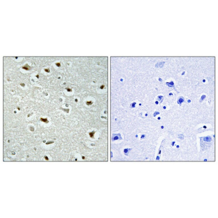 Immunohistochemistry - Anti-ZNF187 Antibody (C11138) - Antibodies.com