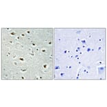 Immunohistochemistry - Anti-ZNF187 Antibody (C11138) - Antibodies.com
