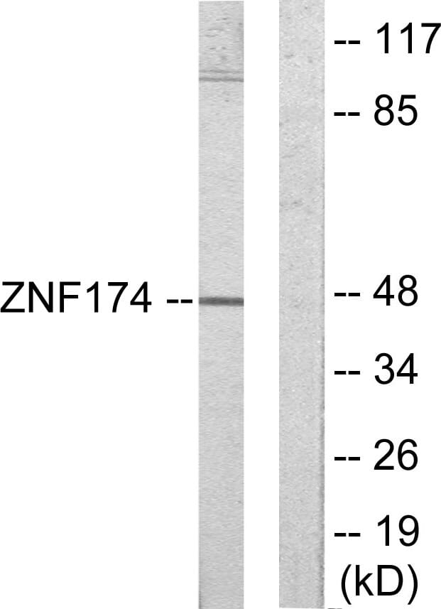 Western blot analysis of lysates from HeLa cells using Anti-ZNF174 Antibody. The right hand lane represents a negative control, where the antibody is blocked by the immunising peptide.