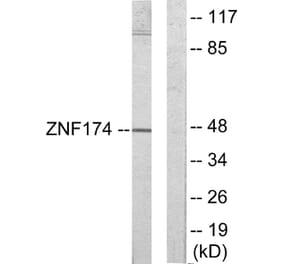 Western Blot - Anti-ZNF174 Antibody (C11098) - Antibodies.com