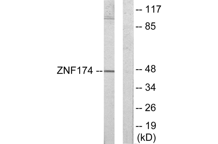 Western Blot - Anti-ZNF174 Antibody (C11098) - Antibodies.com