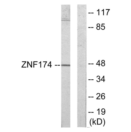Western Blot - Anti-ZNF174 Antibody (C11098) - Antibodies.com