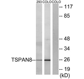 Western Blot - Anti-TSPAN8 Antibody (C10423) - Antibodies.com
