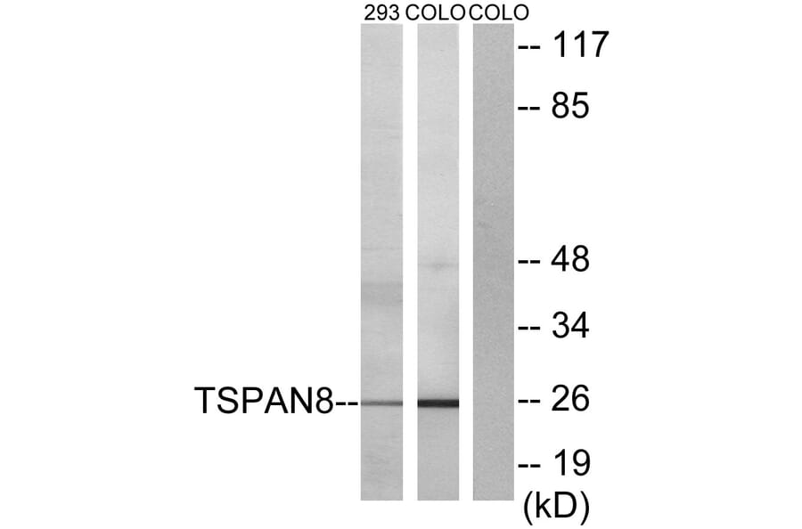 Western Blot - Anti-TSPAN8 Antibody (C10423) - Antibodies.com