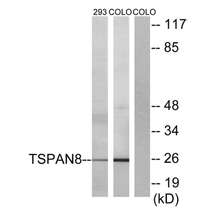 Western Blot - Anti-TSPAN8 Antibody (C10423) - Antibodies.com