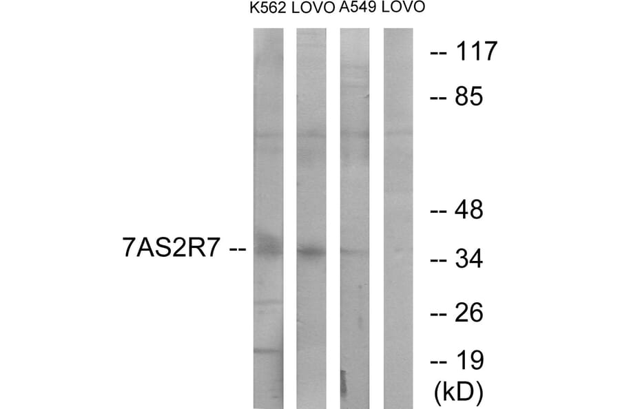 Western Blot - Anti-TAS2R7 Antibody (G767) - Antibodies.com