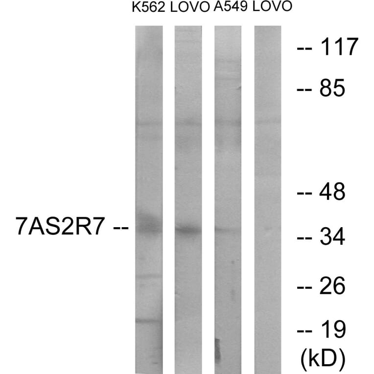 Western Blot - Anti-TAS2R7 Antibody (G767) - Antibodies.com
