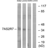 Western Blot - Anti-TAS2R7 Antibody (G767) - Antibodies.com