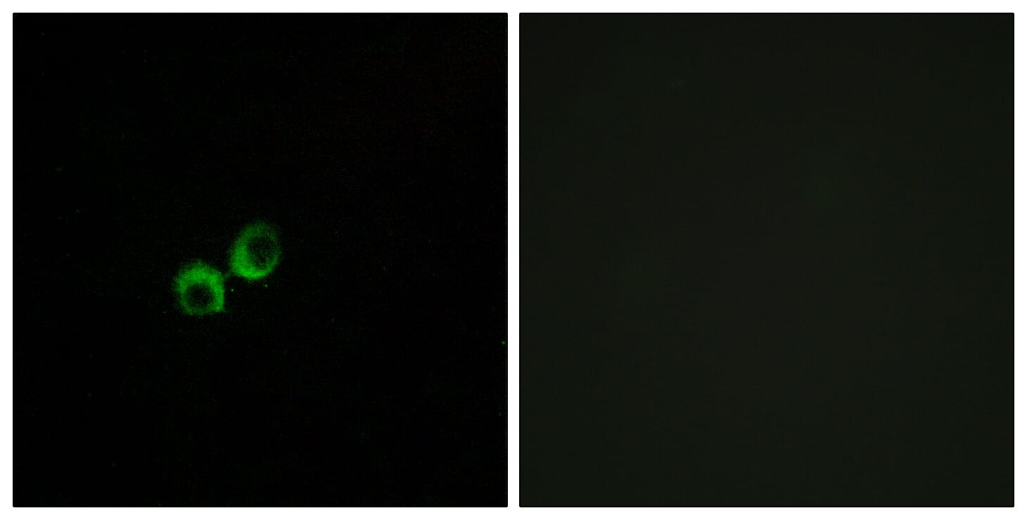 Immunofluorescence analysis of MCF7 cells using Anti-TAS1R3 Antibody. The right hand panel represents a negative control, where the antibody was pre-incubated with the immunising peptide.