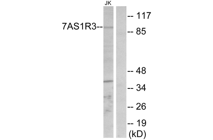 Western Blot - Anti-TAS1R3 Antibody (G780) - Antibodies.com