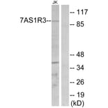 Western Blot - Anti-TAS1R3 Antibody (G780) - Antibodies.com