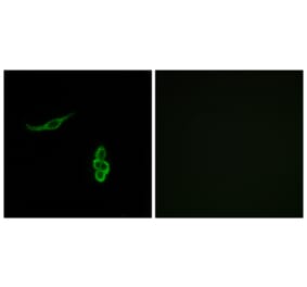 Immunofluorescence - Anti-SCNN1D Antibody (C14438) - Antibodies.com
