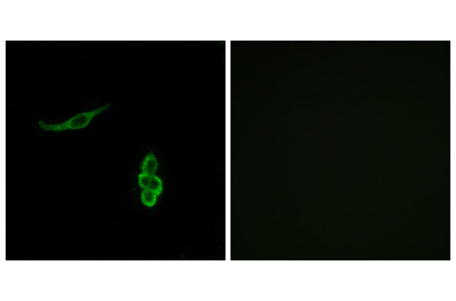 Immunofluorescence - Anti-SCNN1D Antibody (C14438) - Antibodies.com