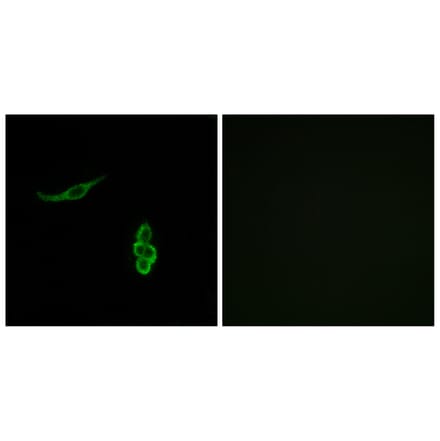 Immunofluorescence - Anti-SCNN1D Antibody (C14438) - Antibodies.com