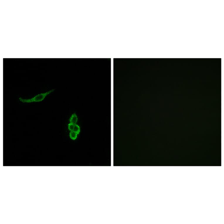 Immunofluorescence - Anti-SCNN1D Antibody (C14438) - Antibodies.com