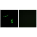 Immunofluorescence - Anti-SCNN1D Antibody (C14438) - Antibodies.com