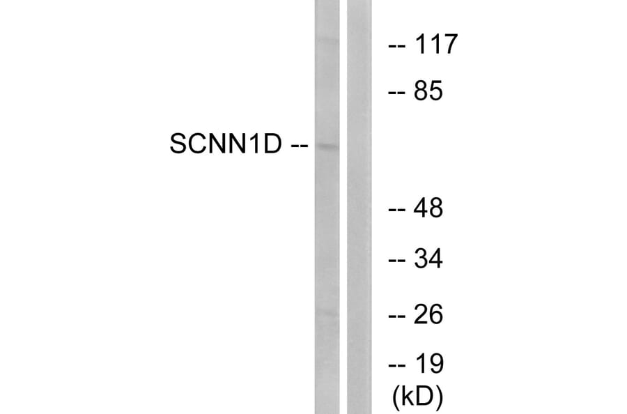 Western Blot - Anti-SCNN1D Antibody (C14438) - Antibodies.com