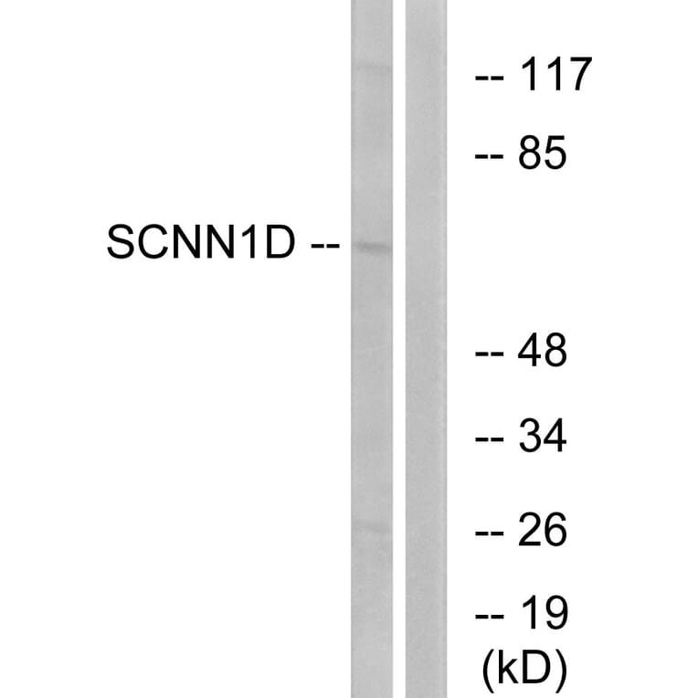 Western Blot - Anti-SCNN1D Antibody (C14438) - Antibodies.com