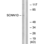 Western Blot - Anti-SCNN1D Antibody (C14438) - Antibodies.com