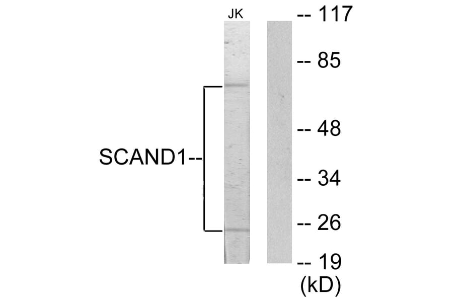 Western Blot - Anti-SCAND1 Antibody (C10759) - Antibodies.com