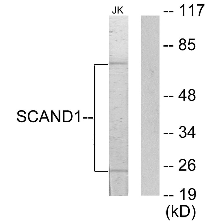 Western Blot - Anti-SCAND1 Antibody (C10759) - Antibodies.com