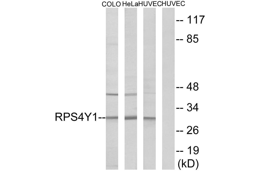 Western Blot - Anti-RPS4Y1 Antibody (C14122) - Antibodies.com