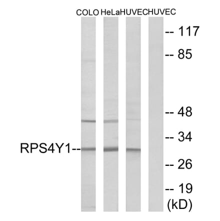 Western Blot - Anti-RPS4Y1 Antibody (C14122) - Antibodies.com