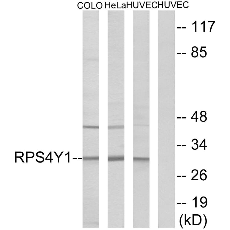 Western Blot - Anti-RPS4Y1 Antibody (C14122) - Antibodies.com