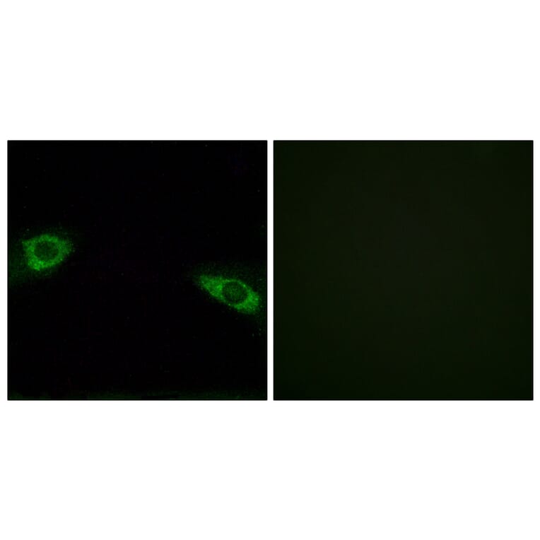 Immunofluorescence - Anti-RPS4Y1 Antibody (C14122) - Antibodies.com