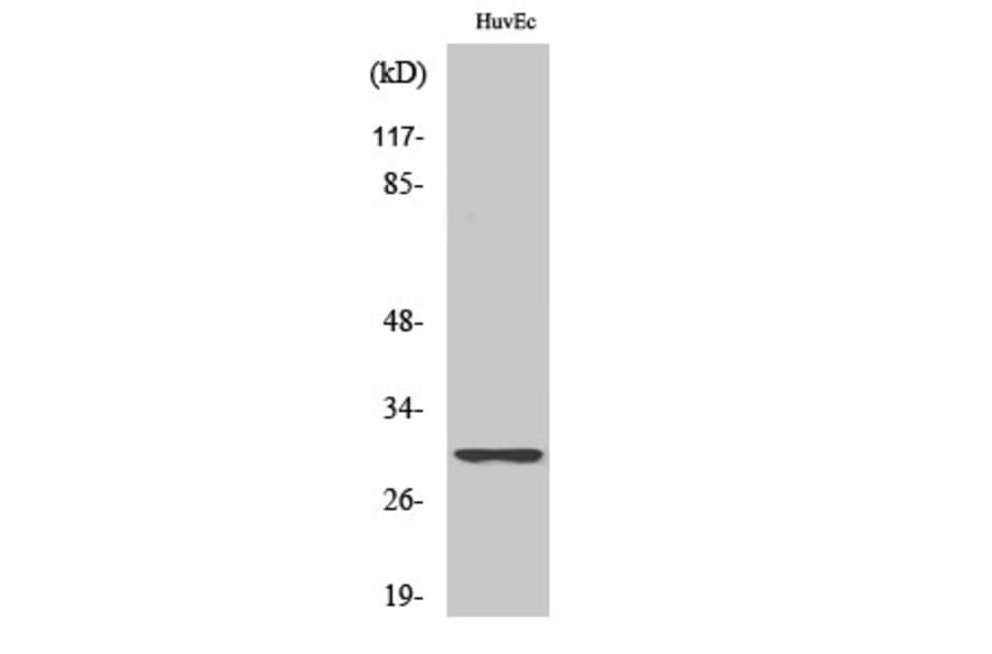 Western Blot - Anti-RPS4Y1 Antibody (C14122) - Antibodies.com