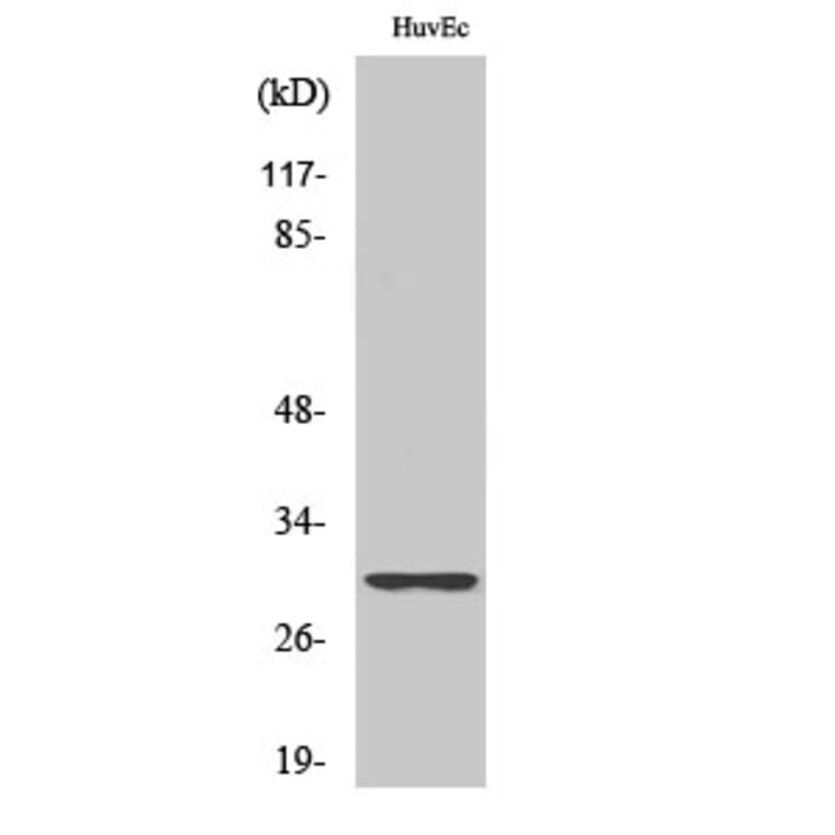 Western Blot - Anti-RPS4Y1 Antibody (C14122) - Antibodies.com