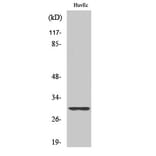 Western Blot - Anti-RPS4Y1 Antibody (C14122) - Antibodies.com