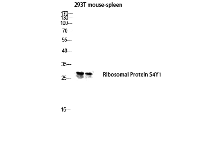 Western Blot - Anti-RPS4Y1 Antibody (C14122) - Antibodies.com