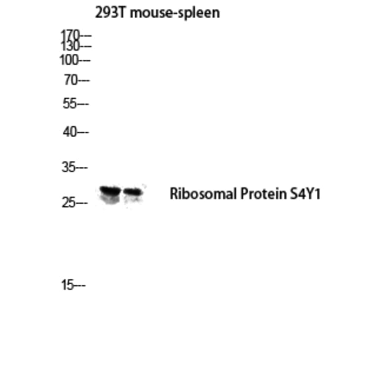 Western Blot - Anti-RPS4Y1 Antibody (C14122) - Antibodies.com