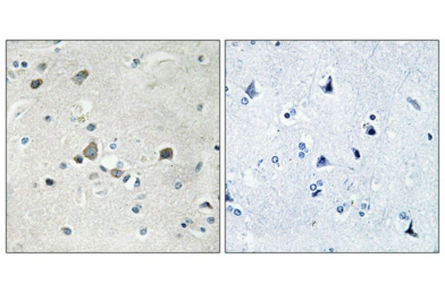 Immunohistochemistry - Anti-RPS4Y1 Antibody (C14122) - Antibodies.com