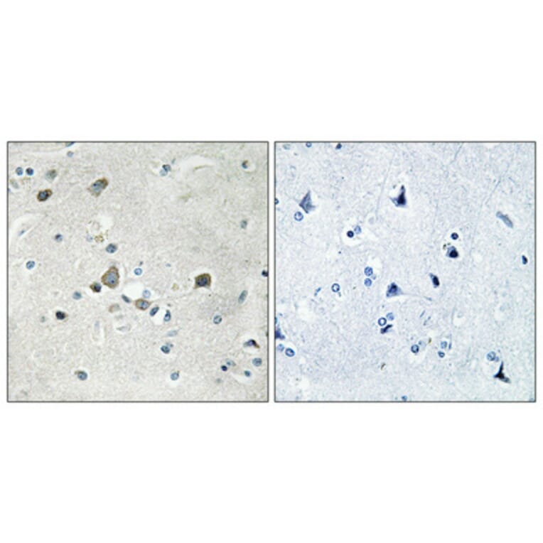 Immunohistochemistry - Anti-RPS4Y1 Antibody (C14122) - Antibodies.com