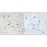 Immunohistochemistry - Anti-RPS4Y1 Antibody (C14122) - Antibodies.com