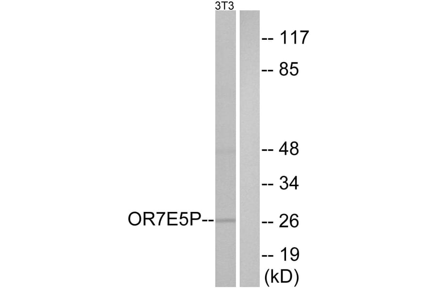 Western Blot - Anti-OR7E5P Antibody (G732) - Antibodies.com