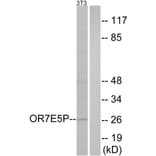 Western Blot - Anti-OR7E5P Antibody (G732) - Antibodies.com