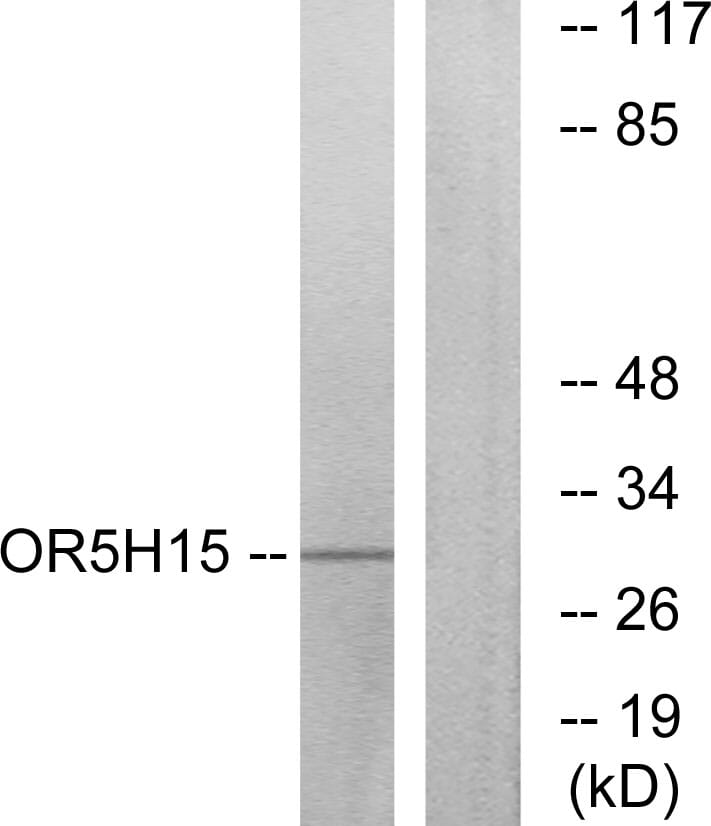 Anti-OR5H15 Antibody (A99510) | Antibodies.com